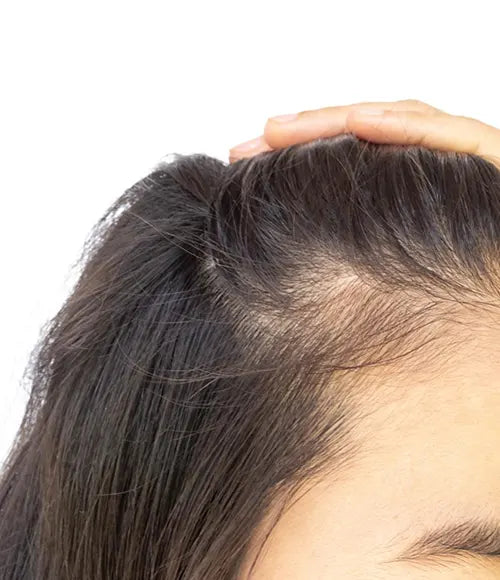 Reduces Hair Thinning